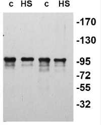slr0156 | ATP-dependent chaperone clpB in the group Antibodies Plant/Algal / Environmental Stress / Heat shock at Agrisera AB (Antibodies for research) (AS08 355)
